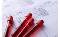 诺华7.7亿美元收购Cadent
