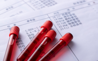 27家江苏药企合揽1200亿！3家狂赚超20亿，22款1类新药、25个首仿上市可期
